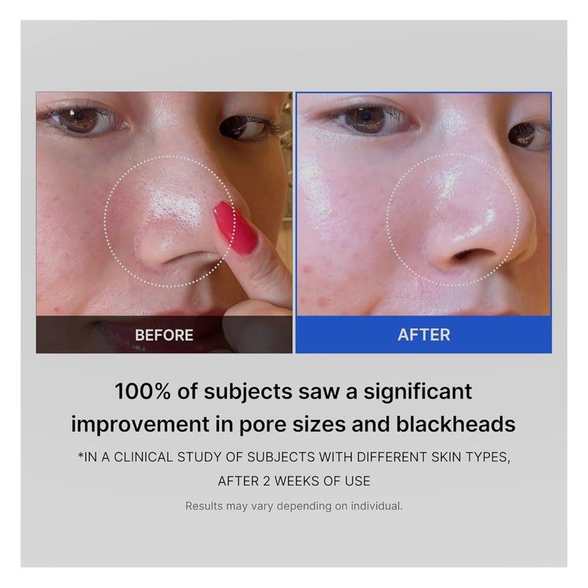 Medicube Zero Pore 2.0 AHA + BHA Facial Toner Pads For Pore Tightening 155g, Pack of 70's