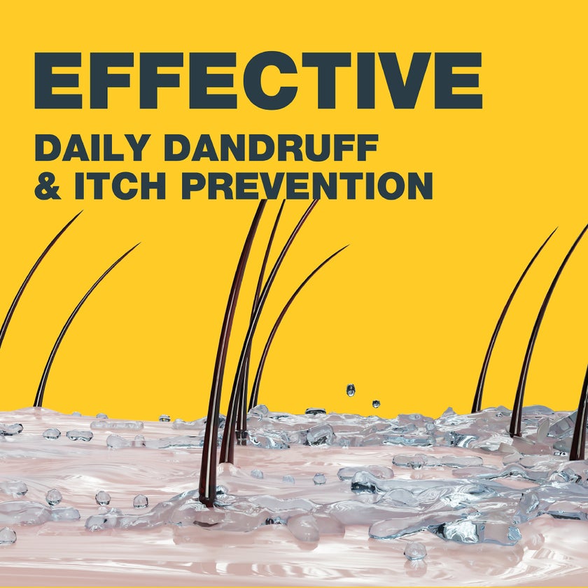 Nizoral Daily Care Anti Dandruff Shampoo For Oily Scalp 200ml 